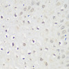 Immunohistochemistry of paraffin-embedded Human esophagus using KPNA3 Polyclonal Antibody at dilution of  1:100 (40x lens).