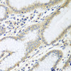 Immunohistochemistry of paraffin-embedded Human stomach using RPN2 Polyclonal Antibody at dilution of  1:100 (40x lens).