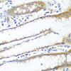 Immunohistochemistry of paraffin-embedded Human stomach using PPP4R1 Polyclonal Antibody at dilution of  1:100 (40x lens).