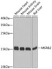 Western blot analysis of extracts of various cell lines using MSRB2 Polyclonal Antibody at dilution of 1:1000.