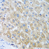 Immunohistochemistry of paraffin-embedded Human liver using UBE2U Polyclonal Antibody at dilution of  1:100 (40x lens).