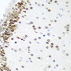 Immunohistochemistry of paraffin-embedded Mouse brain using UBE2U Polyclonal Antibody at dilution of  1:100 (40x lens).