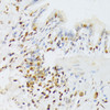 Immunohistochemistry of paraffin-embedded Rat lung using ANKRD52 Polyclonal Antibody at dilution of  1:100 (40x lens).