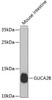 Western blot analysis of extracts of Mouse small intestine using GUCA2B Polyclonal Antibody at dilution of 1:1000.