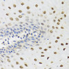 Immunohistochemistry of paraffin-embedded Human esophagus using YTHDF3 Polyclonal Antibody at dilution of  1:100 (40x lens).