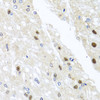 Immunohistochemistry of paraffin-embedded Rat brain using YTHDF3 Polyclonal Antibody at dilution of  1:100 (40x lens).
