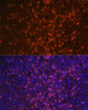 Immunofluorescence analysis of Human spleen using CR2 Polyclonal Antibody at dilution of  1:100 (40x lens). Blue: DAPI for nuclear staining.