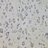 Immunohistochemistry of paraffin-embedded Mouse brain using CRHR1 Polyclonal Antibody at dilution of  1:100 (40x lens).