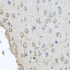 Immunohistochemistry of paraffin-embedded Mouse brain using HBA2 Polyclonal Antibody at dilution of  1:100 (40x lens).