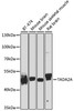 Western blot analysis of extracts of various cell lines using TADA2A Polyclonal Antibody at dilution of 1:1000.