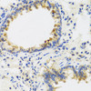 Immunohistochemistry of paraffin-embedded Rat lung using UVRAG Polyclonal Antibody at dilution of  1:100 (40x lens).