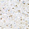 Immunohistochemistry of paraffin-embedded Rat brain using ZBTB17 Polyclonal Antibody at dilution of  1:100 (40x lens).