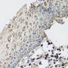Immunohistochemistry of paraffin-embedded Human esophagus using GBF1 Polyclonal Antibody at dilution of  1:100 (40x lens).