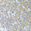 Immunohistochemistry of paraffin-embedded Human liver damage using SYNPO Polyclonal Antibody at dilution of  1:100 (40x lens).