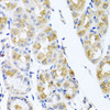 Immunohistochemistry of paraffin-embedded Human stomach using TMEM43 Polyclonal Antibody at dilution of  1:100 (40x lens).