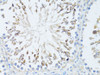Immunohistochemistry of paraffin-embedded Rat testis using TEFM Polyclonal Antibody at dilution of  1:100 (40x lens).