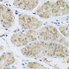 Immunohistochemistry of paraffin-embedded Human stomach using MTERFD3 Polyclonal Antibody at dilution of  1:100 (40x lens).