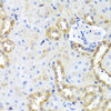 Immunohistochemistry of paraffin-embedded Rat kidney using CGB7 Polyclonal Antibody at dilution of  1:100 (40x lens).