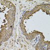 Immunohistochemistry of paraffin-embedded Human prostate using MTIF3 Polyclonal Antibody at dilution of  1:100 (40x lens).