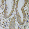 Immunohistochemistry of paraffin-embedded Human stomach using MTIF3 Polyclonal Antibody at dilution of  1:100 (40x lens).