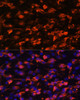 Immunofluorescence analysis of C6 cells using PIK3C2A Polyclonal Antibody at dilution of  1:100. Blue: DAPI for nuclear staining.