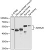 Western blot analysis of extracts of various cell lines using ADRA2B Polyclonal Antibody at dilution of 1:1000.