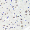 Immunohistochemistry of paraffin-embedded Mouse brain using DLG1 Polyclonal Antibody at dilution of  1:100 (40x lens).