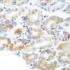 Immunohistochemistry of paraffin-embedded Human stomach using DLG1 Polyclonal Antibody at dilution of  1:100 (40x lens).