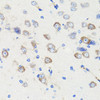 Immunohistochemistry of paraffin-embedded Rat brain using DLG1 Polyclonal Antibody at dilution of  1:100 (40x lens).