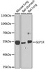 Western blot analysis of extracts of various cell lines using GLP1R Polyclonal Antibody at dilution of 1:1000.