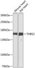 Western blot analysis of extracts of various cell lines using THBS2 Polyclonal Antibody at dilution of 1:1000.