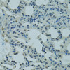 Immunohistochemistry of paraffin-embedded Rat lung using PRDM2 Polyclonal Antibody at dilution of  1:100 (40x lens).