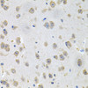 Immunohistochemistry of paraffin-embedded Mouse brain using GNE Polyclonal Antibody at dilution of  1:100 (40x lens).