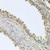 Immunohistochemistry of paraffin-embedded Human prostate using MEMO1 Polyclonal Antibody at dilution of  1:100 (40x lens).