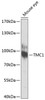 Western blot analysis of extracts of Mouse eye using TMC1 Polyclonal Antibody at dilution of 1:1000.