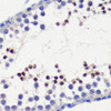 Immunohistochemistry of paraffin-embedded Mouse testis using HFM1 Polyclonal Antibody at dilution of  1:100 (40x lens).