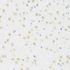 Immunohistochemistry of paraffin-embedded Mouse brain using DDX50 Polyclonal Antibody at dilution of  1:100 (40x lens).