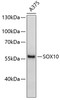 Western blot analysis of extracts of A-375 cells using SOX10 Polyclonal Antibody.