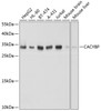 Western blot analysis of extracts of various cell lines using CACYBP Polyclonal Antibody at dilution of 1:1000.