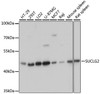 Western blot analysis of extracts of various cell lines using SUCLG2 Polyclonal Antibody at dilution of 1:3000.
