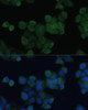 Immunofluorescence analysis of HeLa cells using ZFYVE9 Polyclonal Antibody at dilution of  1:100. Blue: DAPI for nuclear staining.