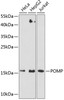 Western blot analysis of extracts of various cell lines using POMP Polyclonal Antibody at dilution of 1:3000.