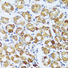Immunohistochemistry of paraffin-embedded Human stomach using C1QC Polyclonal Antibody at dilution of  1:100 (40x lens).