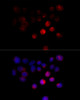 Immunofluorescence analysis of 293T cells using TOM1 Polyclonal Antibody at dilution of  1:100 (40x lens). Blue: DAPI for nuclear staining.