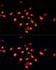 Immunofluorescence analysis of C6 cells using GTF3C4 Polyclonal Antibody at dilution of  1:100 (40x lens). Blue: DAPI for nuclear staining.