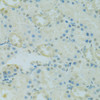 Immunohistochemistry of paraffin-embedded Rat kidney using PHOX2B Polyclonal Antibody at dilution of  1:100 (40x lens).