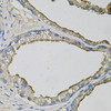 Immunohistochemistry of paraffin-embedded Human prostate using LCN1 Polyclonal Antibody at dilution of  1:100 (40x lens).