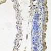 Immunohistochemistry of paraffin-embedded Mouse lung using NDUFA6 Polyclonal Antibody at dilution of  1:100 (40x lens).