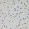 Immunohistochemistry of paraffin-embedded Mouse brain using PTK7 Polyclonal Antibody at dilution of  1:100 (40x lens).