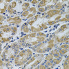 Immunohistochemistry of paraffin-embedded Human stomach using PTK7 Polyclonal Antibody at dilution of  1:100 (40x lens).